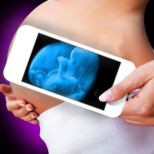 Aplicativo de Ultrassom no Celular